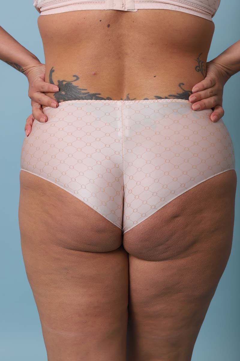 Shorty  Bijou du jour